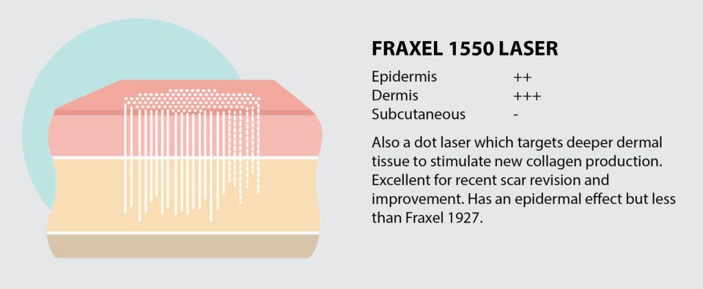 Fraxel 1550 Perth