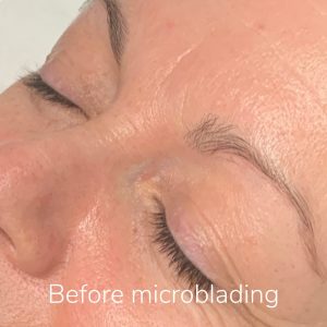 Before microblading