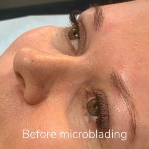 Eyebrows before microblading